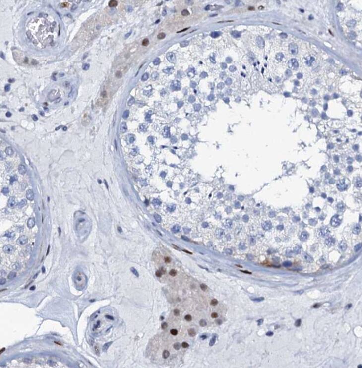 Immunohistochemistry-Paraffin MFSD5 Antibody - BSA Free