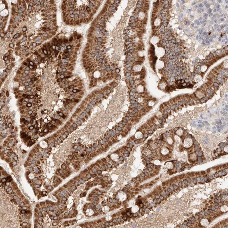 Staining of human duodenum shows strong cytoplasmic positivity in glandular cells.