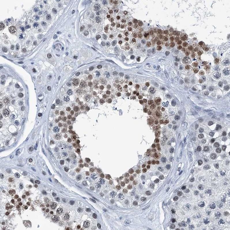 Immunohistochemistry-Paraffin TRPT1 Antibody - BSA Free