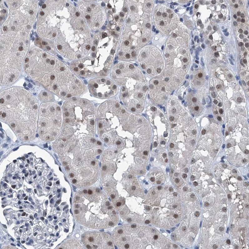 Immunohistochemistry-Paraffin TRPT1 Antibody - BSA Free
