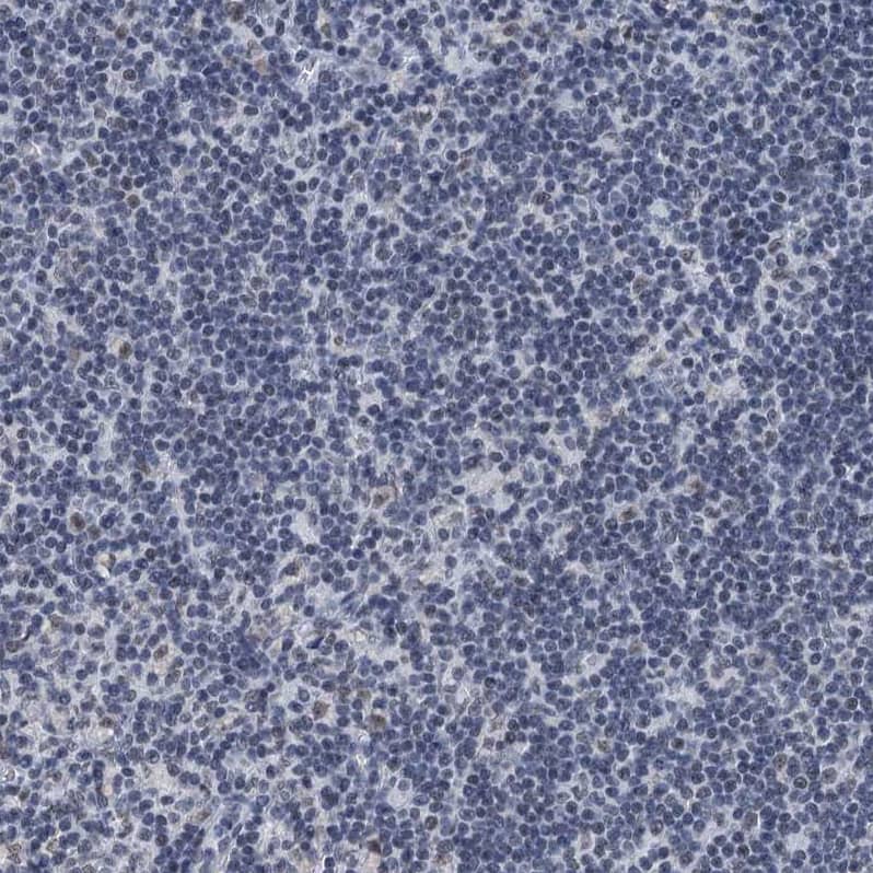 Immunohistochemistry-Paraffin TRPT1 Antibody - BSA Free