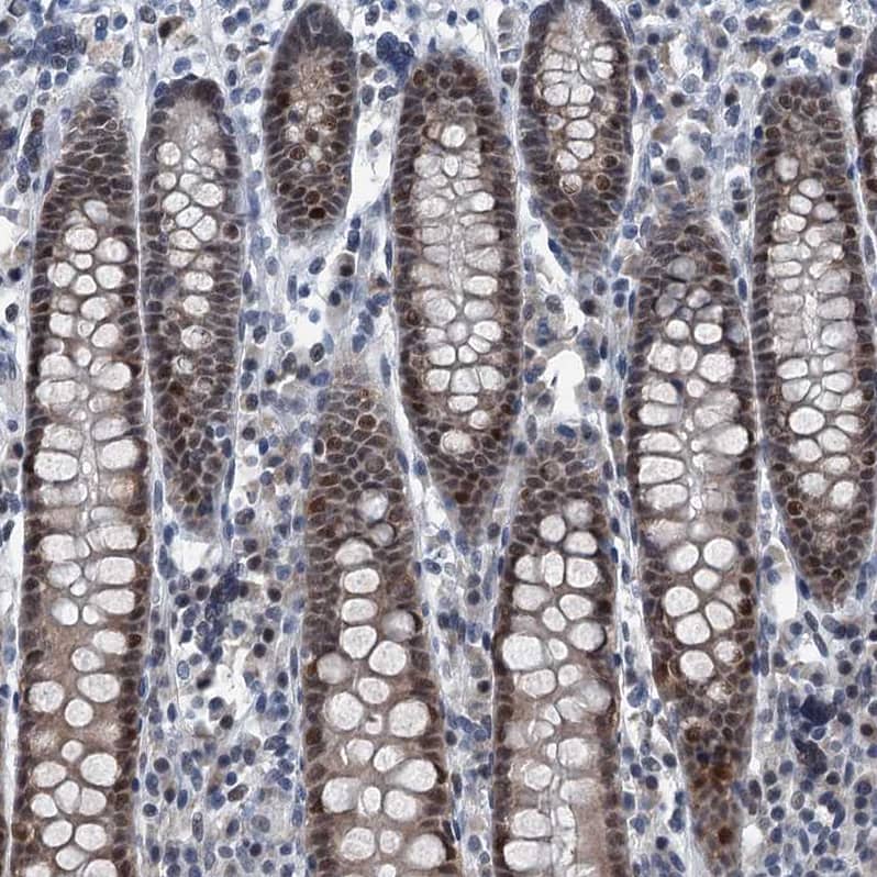 Immunohistochemistry-Paraffin TRPT1 Antibody - BSA Free
