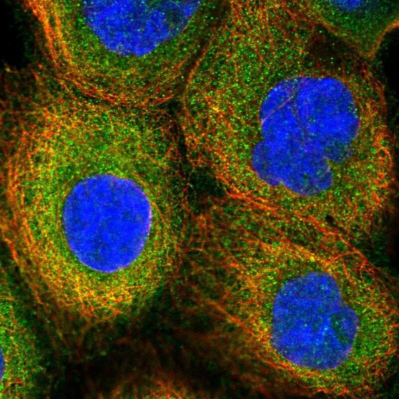 Staining of human cell line A-431 shows localization to plasma membrane & cytosol.