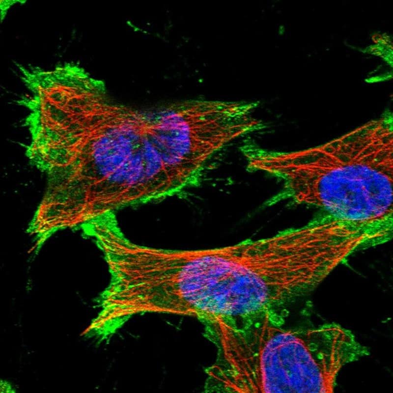 Staining of human cell line U-251 MG shows localization to plasma membrane.