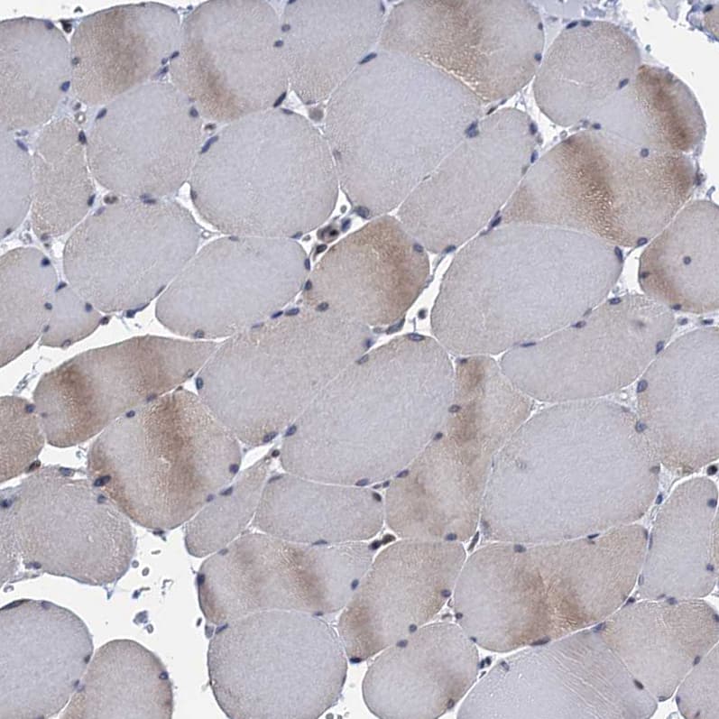 Immunohistochemistry-Paraffin TMEM205 Antibody - BSA Free