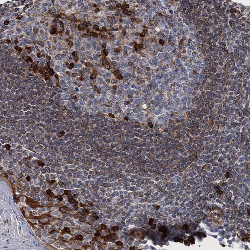 Immunohistochemistry-Paraffin TMEM205 Antibody - BSA Free