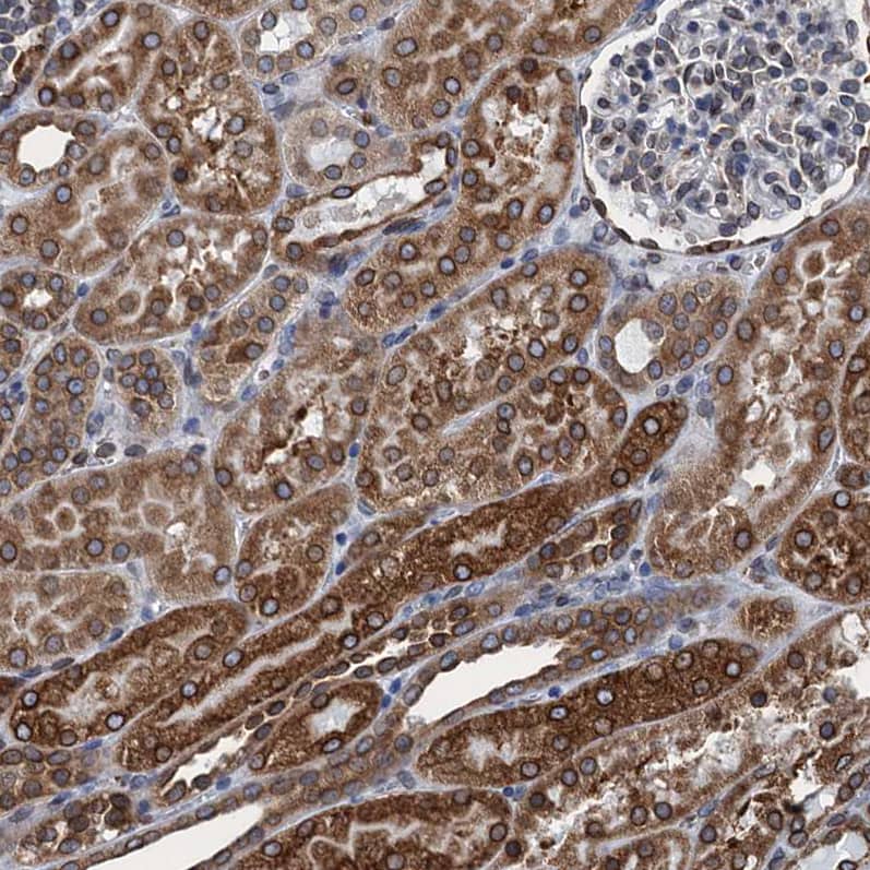 Immunohistochemistry-Paraffin TMEM205 Antibody - BSA Free