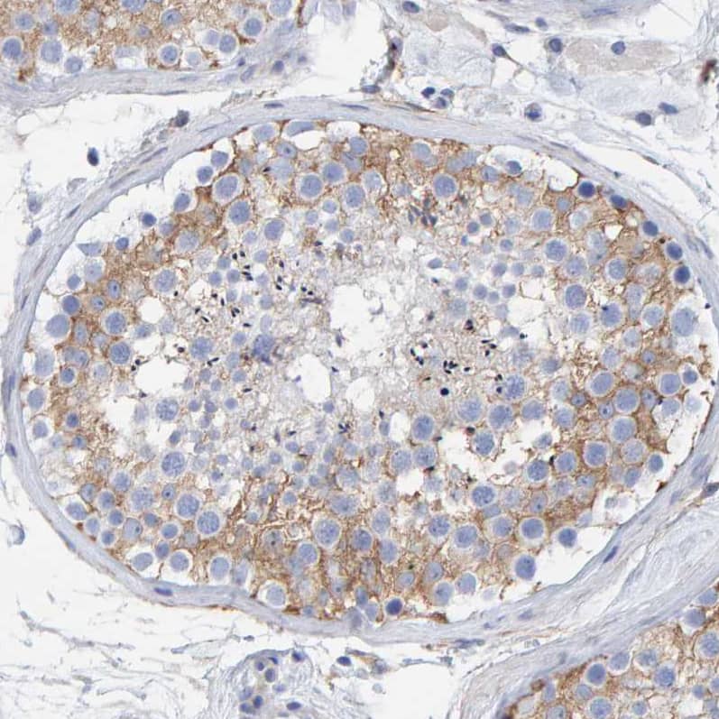 Immunohistochemistry-Paraffin MAP1B Antibody - BSA Free