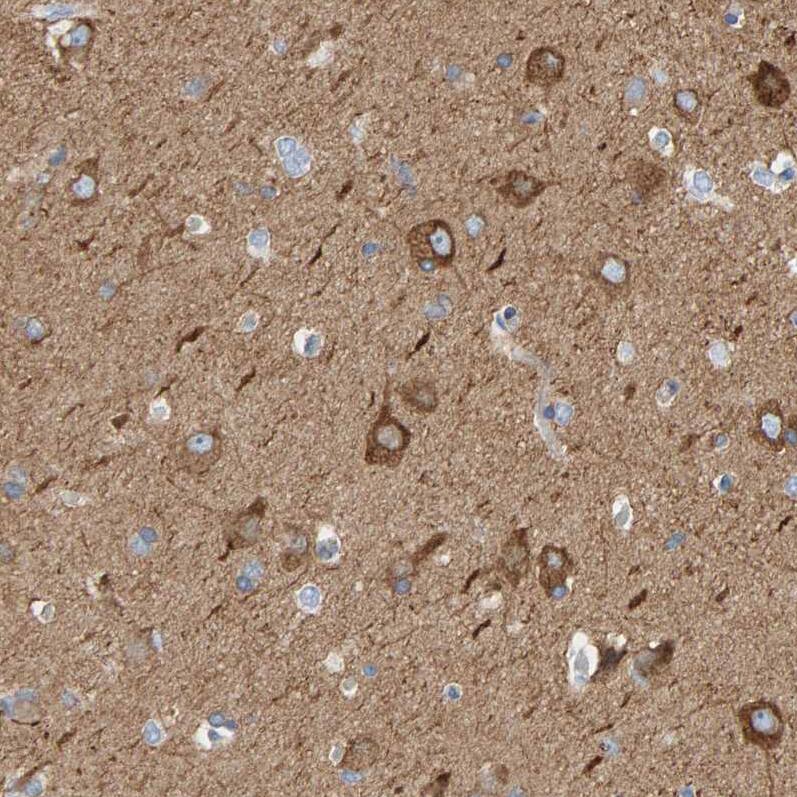 Immunohistochemistry-Paraffin MAP1B Antibody - BSA Free
