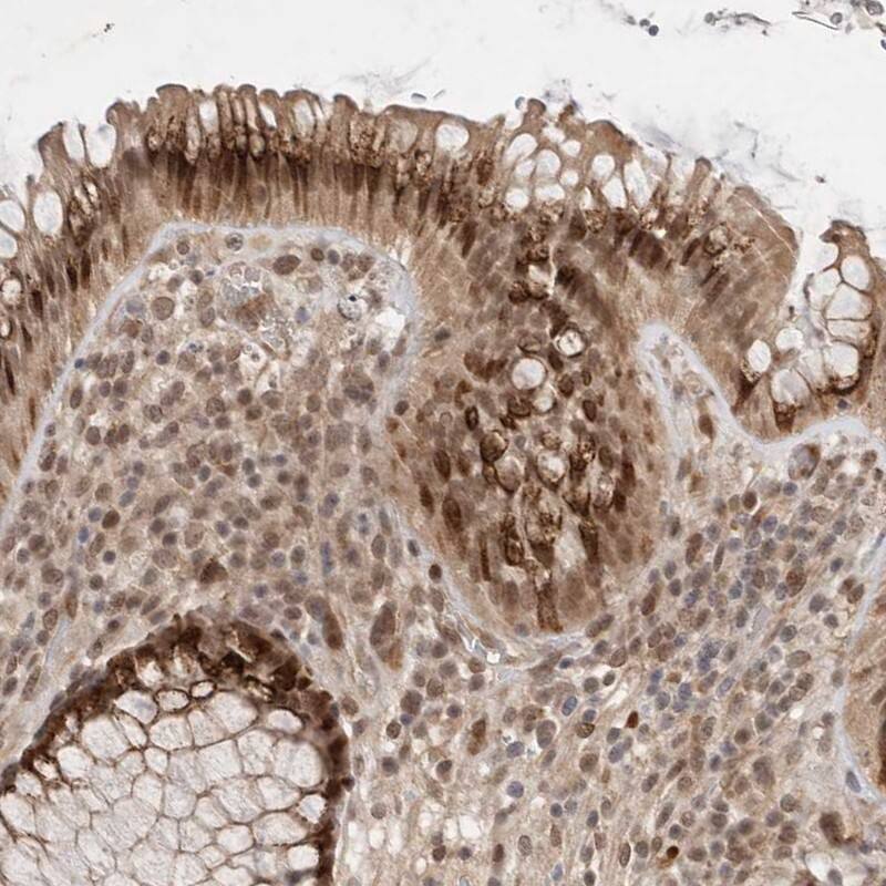 <b>Independent Antibodies Validation. </b>Staining of human rectum shows strong nuclear and cytoplasmic positivity in glandular cells.