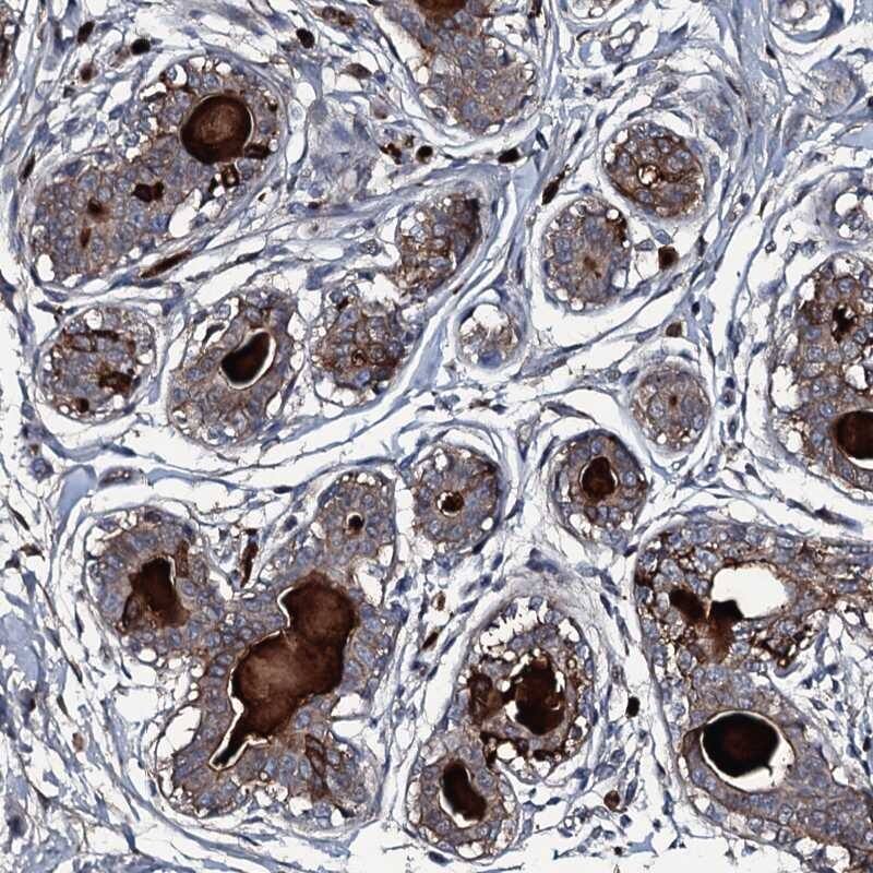 Staining of human breast shows moderate cytoplasmic positivity in glandular cells and distinct positivity in extracellular material.