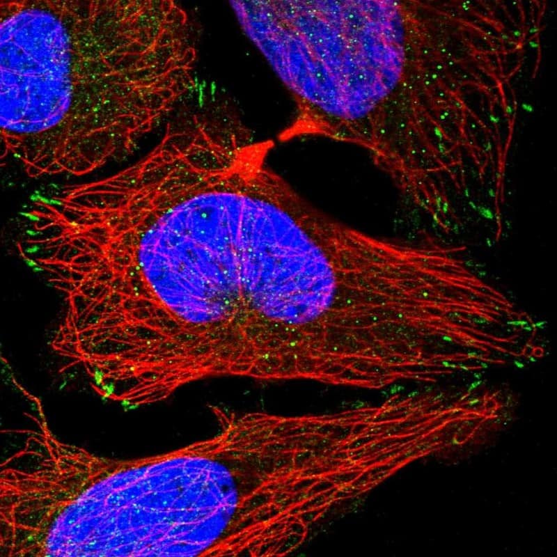 Staining of human cell line U-2 OS shows localization to focal adhesion sites.