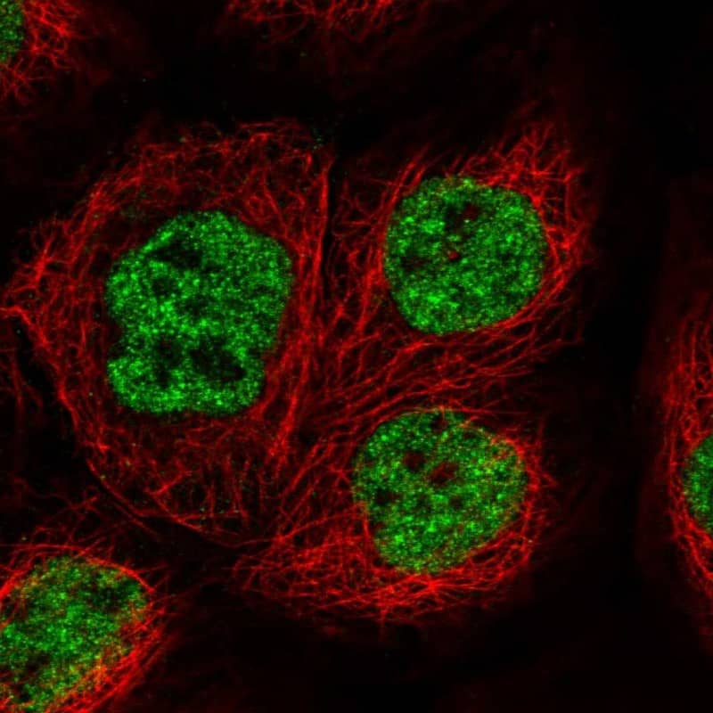 Staining of human cell line A-431 shows localization to nucleoplasm.