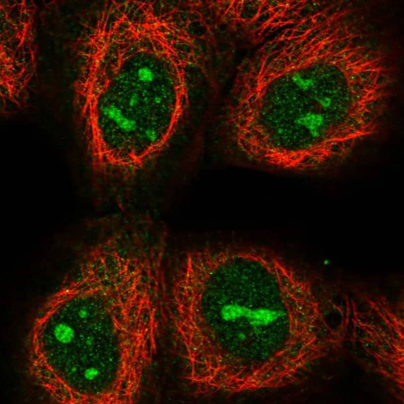 Staining of human cell line A-431 shows localization to nucleoli.