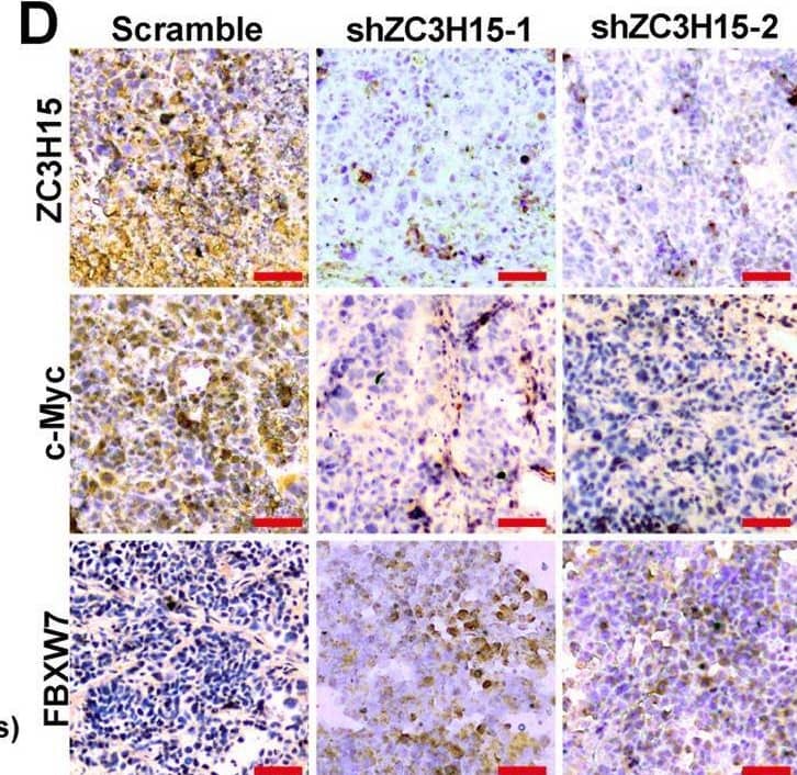 ZC3H15 promoted the colony formation and tumor growth of GC cells.A Soft agar assays were performed to detect the colony formation ability of GC cells. B, C Xenograft assays were performed in ZC3H15-knockdown HGC-27 cells. The weight and volumes of tumors were analyzed and P-values were indicated. D Immunohistochemical staining assays were performed to detect the expression of ZC3H15, c-Myc, and FBXW7 in ZC3H15-knockdown tumor tissues and control tissues. All data were expressed as mean +/- SD. Student’s t-test was performed to analyzed significance, *P < 0.05, **P < 0.01, ***P < 0.001. Image collected and cropped by CiteAb from the following open publication (//pubmed.ncbi.nlm.nih.gov/35064102), licensed under a CC-BY license. Not internally tested by Novus Biologicals.