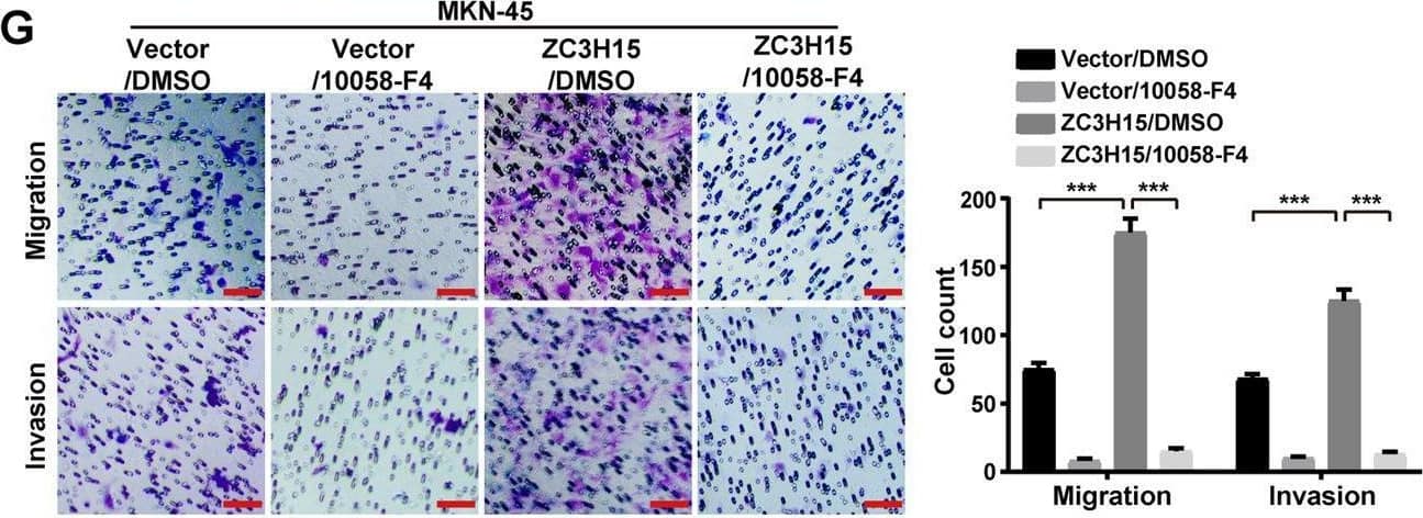 ZC3H15 promoted GC progression by increasing c-Myc expression.A GSEA enrichment plots of c-Myc target genes in high ZC3H15 expression versus low ZC3H15 expression TCGA GCs. Normalized enrichment score (NES), false discovery rate (FDR), and P-values were shown in the plot. B, C ZC3H15 modulated the protein and mRNA expression of c-Myc in HGC-27 and MKN-45 cells. D, E MTT assays were performed to examine the inhibitory effect of 10058-F4 (100 μM) on the cell proliferation of ZC3H15-overexpression HGC-27 and MKN-45 cells. F, G Transwell assays were performed to examine the inhibitory effect of 10058-F4 (100 μM) on the cell migration and invasion of ZC3H15-overexpression HGC-27 and MKN-45 cells. All data were expressed as mean +/- SD. Student’s t-test was performed to analyzed significance, *P < 0.05, **P < 0.01, ***P < 0.001. Image collected and cropped by CiteAb from the following open publication (//pubmed.ncbi.nlm.nih.gov/35064102), licensed under a CC-BY license. Not internally tested by Novus Biologicals.