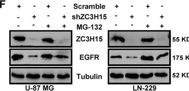 ZC3H15 activates the EGFR-mediated signaling pathway by increasing EGFR protein stability.A Western blot analysis was performed to detect the expression of EGFR signaling proteins (EGFR, p-EGFR, AKT, p-AKT) of GBM cells. B The inhibitory effect of EGFR inhibitor-erlotinib on the proliferation activity in control or ZC3H15 overexpression cells. C, D The inhibitory effect of EGFR inhibitor-erlotinib on the invasion and migration in control and ZC3H15 overexpression cells. The number of cells invaded and migrated were counted and analyzed. E Western blot analysis was performed to detect the protein expression of EGFR in the indicated cells. F Cells were treated with MG-132 for 8 h before harvesting to detect the protein level of EGFR in the indicated cells. G, H CHX treatment for time gradient (0 h, 2 h, 4 h, 8 h) with the ZC3H15 overexpression and control group. To determine whether ZC3H15 could stabilize EGFR. The gray value was calculated by ImageJ. I HA-tagged Ub plasmid and Flag-tagged ZC3H15 plasmid were co-transfected into the cells. The ubiquitinated EGFR proteins were pulled down with anti-HA antibody and immunoblotted with ant-EGFR antibody. All data were expressed as mean +/- SD. Student’s t test was performed to analyzed significance. *P < 0.05, **P < 0.01, ***P < 0.001. Image collected and cropped by CiteAb from the following open publication (//pubmed.ncbi.nlm.nih.gov/35027542), licensed under a CC-BY license. Not internally tested by Novus Biologicals.
