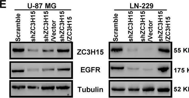 ZC3H15 activates the EGFR-mediated signaling pathway by increasing EGFR protein stability.A Western blot analysis was performed to detect the expression of EGFR signaling proteins (EGFR, p-EGFR, AKT, p-AKT) of GBM cells. B The inhibitory effect of EGFR inhibitor-erlotinib on the proliferation activity in control or ZC3H15 overexpression cells. C, D The inhibitory effect of EGFR inhibitor-erlotinib on the invasion and migration in control and ZC3H15 overexpression cells. The number of cells invaded and migrated were counted and analyzed. E Western blot analysis was performed to detect the protein expression of EGFR in the indicated cells. F Cells were treated with MG-132 for 8 h before harvesting to detect the protein level of EGFR in the indicated cells. G, H CHX treatment for time gradient (0 h, 2 h, 4 h, 8 h) with the ZC3H15 overexpression and control group. To determine whether ZC3H15 could stabilize EGFR. The gray value was calculated by ImageJ. I HA-tagged Ub plasmid and Flag-tagged ZC3H15 plasmid were co-transfected into the cells. The ubiquitinated EGFR proteins were pulled down with anti-HA antibody and immunoblotted with ant-EGFR antibody. All data were expressed as mean +/- SD. Student’s t test was performed to analyzed significance. *P < 0.05, **P < 0.01, ***P < 0.001. Image collected and cropped by CiteAb from the following open publication (//pubmed.ncbi.nlm.nih.gov/35027542), licensed under a CC-BY license. Not internally tested by Novus Biologicals.