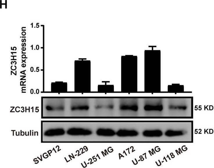 ZC3H15 is commonly upregulated in GBM and correlates with poor prognosis.A, B ZC3H15 gene expression was obtained from TCGA and CGGA database. Box plot of ZC3H15 expression levels in Grade and Histology glioma set with the log-rank test P-values indicated. C Box plot of ZC3H15 expression levels in Copy number glioma set with the log-rank test P-values indicated. D–F The correlation between ZC3H15 expression levels and survival rate were obtained from TCGA, Phillips, and Tumor Glioma-kawaguchi-50 and were performed through Kaplan–Meier (K–M) analysis, the log-rank test P-value was indicated. G Representative immunohistochemistry staining of ZC3H15 expression level in normal tissue and different grades of GBM. And analysis based on the staining of normal tissue (eight samples) and different grades of GBM (eight samples of each group). H The protein and mRNA expression profile of ZC3H15 was examined by qRT-PCR and Western Blot assay. All data were expressed as mean +/- SD. Student’s t test was performed to analyzed significance. *P < 0.05, **P < 0.01, ***P < 0.001. Image collected and cropped by CiteAb from the following open publication (//pubmed.ncbi.nlm.nih.gov/35027542), licensed under a CC-BY license. Not internally tested by Novus Biologicals.