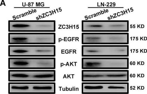 ZC3H15 activates the EGFR-mediated signaling pathway by increasing EGFR protein stability.A Western blot analysis was performed to detect the expression of EGFR signaling proteins (EGFR, p-EGFR, AKT, p-AKT) of GBM cells. B The inhibitory effect of EGFR inhibitor-erlotinib on the proliferation activity in control or ZC3H15 overexpression cells. C, D The inhibitory effect of EGFR inhibitor-erlotinib on the invasion and migration in control and ZC3H15 overexpression cells. The number of cells invaded and migrated were counted and analyzed. E Western blot analysis was performed to detect the protein expression of EGFR in the indicated cells. F Cells were treated with MG-132 for 8 h before harvesting to detect the protein level of EGFR in the indicated cells. G, H CHX treatment for time gradient (0 h, 2 h, 4 h, 8 h) with the ZC3H15 overexpression and control group. To determine whether ZC3H15 could stabilize EGFR. The gray value was calculated by ImageJ. I HA-tagged Ub plasmid and Flag-tagged ZC3H15 plasmid were co-transfected into the cells. The ubiquitinated EGFR proteins were pulled down with anti-HA antibody and immunoblotted with ant-EGFR antibody. All data were expressed as mean +/- SD. Student’s t test was performed to analyzed significance. *P < 0.05, **P < 0.01, ***P < 0.001. Image collected and cropped by CiteAb from the following open publication (//pubmed.ncbi.nlm.nih.gov/35027542), licensed under a CC-BY license. Not internally tested by Novus Biologicals.