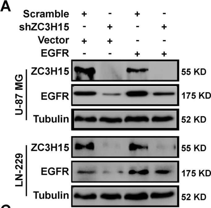 EGFR overexpression significantly restored cell proliferation, migration, and invasion of ZC3H15-knockdown GBM cells.A The protein level of ZC3H15 and EGFR were detected in the indicated GBM cells. B MTT assays were performed to examine the effect of EGFR overexpression on the cell proliferation of ZC3H15-knockdown GBM cells. C, D Transwell assays were used to detect the effects of EGFR overexpression on cell migration and invasion of ZC3H15-knockdown GBM cells. All data were expressed as mean +/- SD. Student’s t test was performed to analyzed significance. *P < 0.05, **P < 0.01, ***P < 0.001. Image collected and cropped by CiteAb from the following open publication (//pubmed.ncbi.nlm.nih.gov/35027542), licensed under a CC-BY license. Not internally tested by Novus Biologicals.