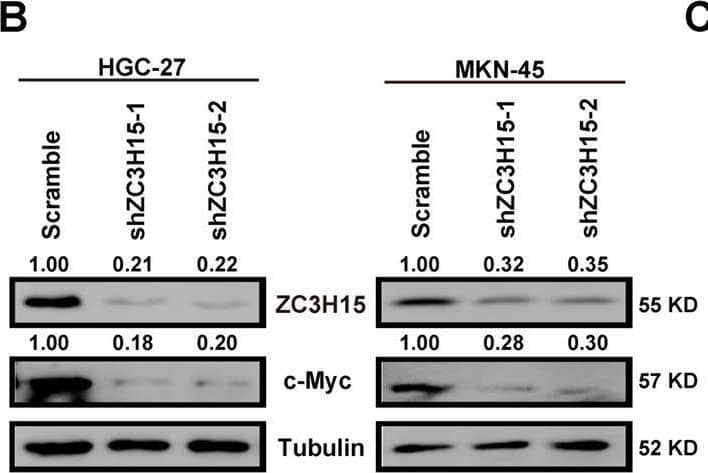 ZC3H15 promoted GC progression by increasing c-Myc expression.A GSEA enrichment plots of c-Myc target genes in high ZC3H15 expression versus low ZC3H15 expression TCGA GCs. Normalized enrichment score (NES), false discovery rate (FDR), and P-values were shown in the plot. B, C ZC3H15 modulated the protein and mRNA expression of c-Myc in HGC-27 and MKN-45 cells. D, E MTT assays were performed to examine the inhibitory effect of 10058-F4 (100 μM) on the cell proliferation of ZC3H15-overexpression HGC-27 and MKN-45 cells. F, G Transwell assays were performed to examine the inhibitory effect of 10058-F4 (100 μM) on the cell migration and invasion of ZC3H15-overexpression HGC-27 and MKN-45 cells. All data were expressed as mean +/- SD. Student’s t-test was performed to analyzed significance, *P < 0.05, **P < 0.01, ***P < 0.001. Image collected and cropped by CiteAb from the following open publication (//pubmed.ncbi.nlm.nih.gov/35064102), licensed under a CC-BY license. Not internally tested by Novus Biologicals.