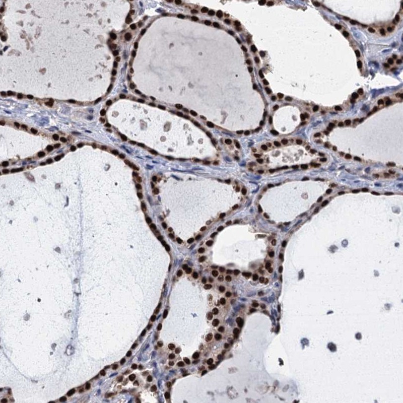 Immunohistochemistry-Paraffin TSEN34 Antibody - BSA Free