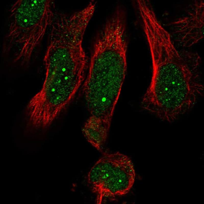 Immunocytochemistry/ Immunofluorescence MED19 Antibody - BSA Free