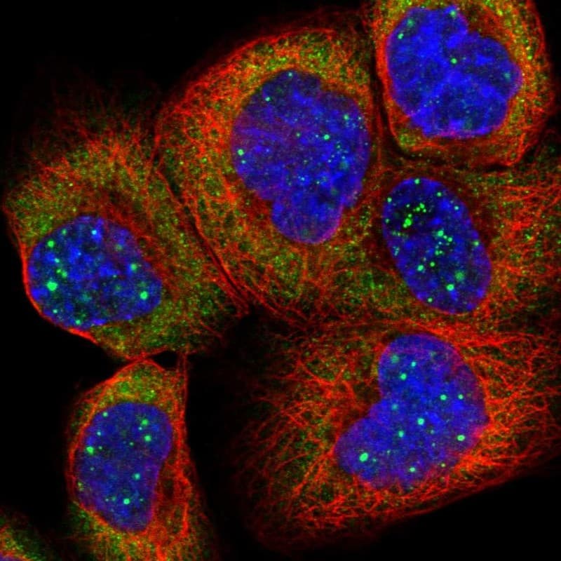 Staining of human cell line A-431 shows localization to nuclear bodies, cytosol & endoplasmic reticulum.
