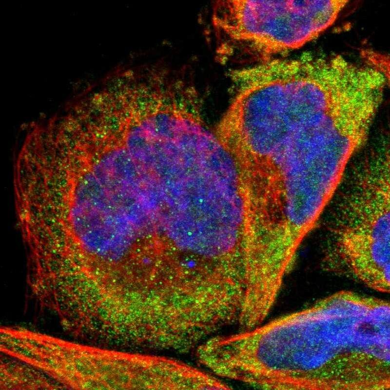 Staining of human cell line A-431 shows localization to cytosol.
