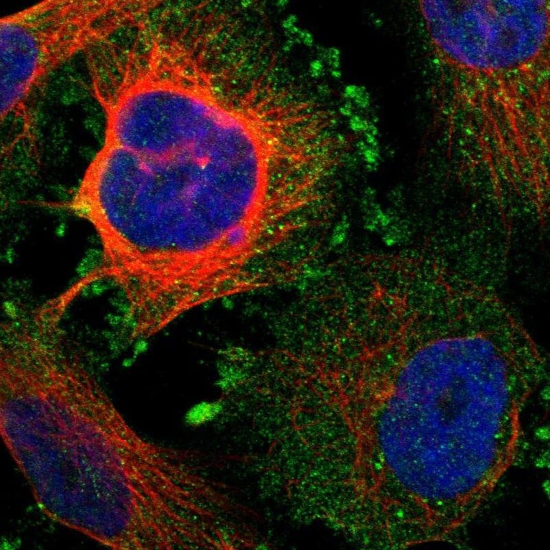 Staining of human cell line U-251 MG shows localization to plasma membrane & cytosol.