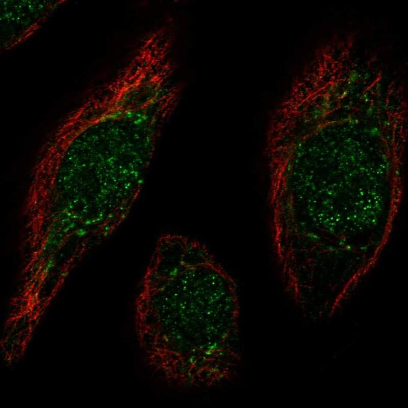 Staining of human cell line hTCEpi shows localization to nucleus & the Golgi apparatus.