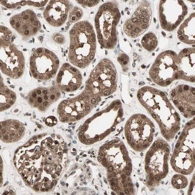 Immunohistochemistry-Paraffin ZNF44 Antibody - BSA Free