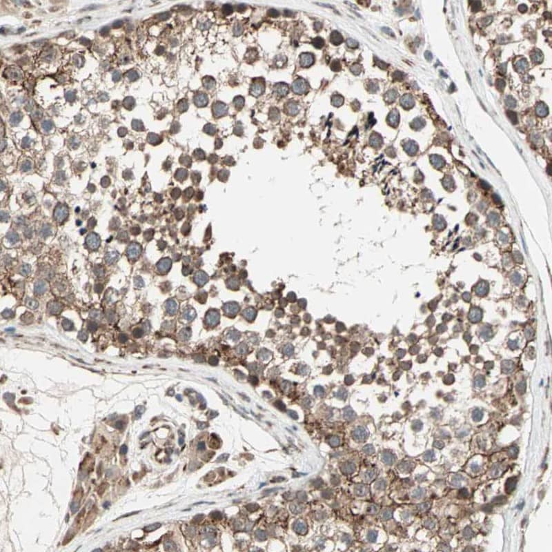 Immunohistochemistry-Paraffin ZNF37A Antibody - BSA Free