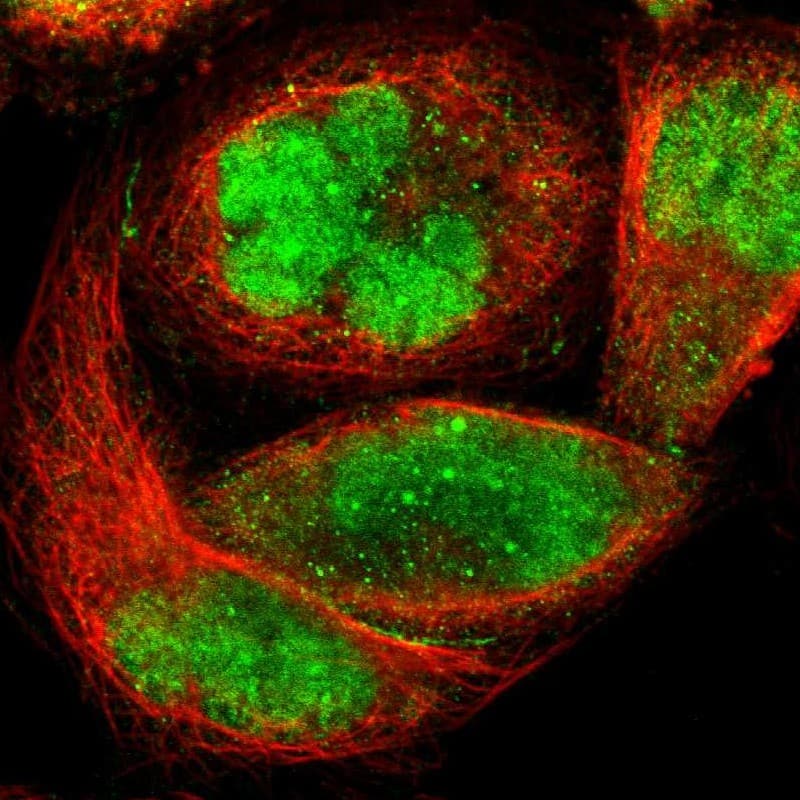 Staining of human cell line A-431 shows localization to nucleus & nuclear bodies.
