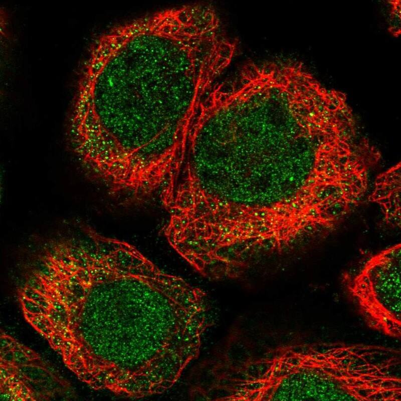 Staining of human cell line A-431 shows localization to nucleoplasm & cytosol.