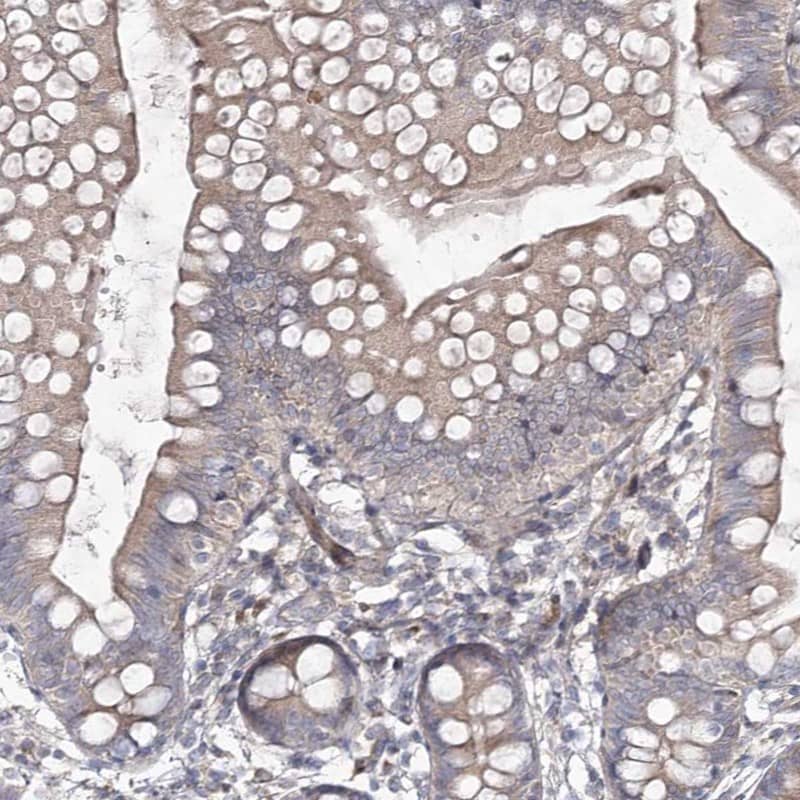 Immunohistochemistry-Paraffin CIB2 Antibody - BSA Free