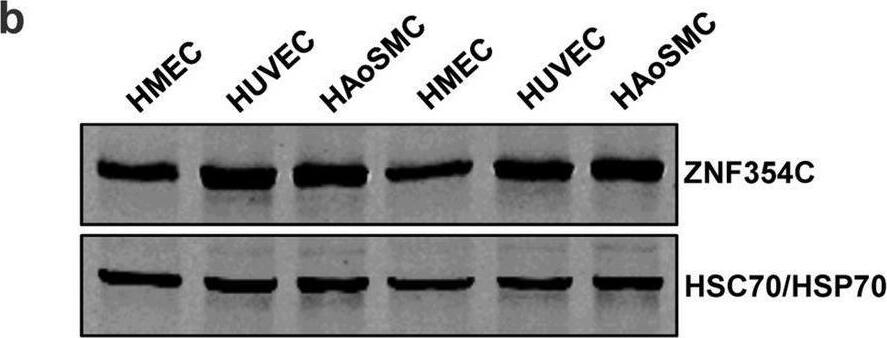 Zinc Finger Protein 354C (ZNF354C) overexpression leads to inhibition of sprouting in HMEC-1. (a) RNA expression level as measured with RT-qPCR of ZNF354C in different cell types. Data is normalised to HUVEC batch 1 (set as 1) and to b-actin. n = 3. Data are mean +/- SEM. (b) Representative western blot of HUVEC, HMEC-1 and HAoSMC. ZNF354C antibody was used. HSC70/HSP70 antibodies served as loading control. (c) Immunofluorescence with an antibody against ZNF354C in HMEC-1, HUVEC and HAoSMC. Nuclei were stained with DAPI. Scale bar indicates 20 um. (d) RT-qPCR of ZNF354C after overexpression (OE) of pCMV6-ZNF354C (354C) in HMEC-1, HUVEC and HAoSMC. PCMV6-entry was used as negative control (CTL). Data is normalized to b-actin. n = 5. Data are mean +/- SEM. Mann–Whitney t-test; *P < 0.05. (e) Representative western blot of untreated (native) HMEC-1, HUVEC and HAoSMC or after overexpression of pCMV6-ZNF354C (ZNF354C) or pCMV6-entry (CTL). ZNF354C, Flag or b-actin antibodies were used. (f) Immunofluorescence with an antibody against ZNF354C in HMEC-1 after overexpression of pCMV6-ZNF354C or pCMV6-entry. Nuclei were stained with DAPI. Scale bar indicates 20 um. (g, h) Spheroid outgrowth assay quantification of sprout number (g) and cumulative sprout length (h) after overexpression of pCMV6-ZNF354C (354C) or pCMV6-entry (NC). Cells were studied under basal conditions or after treatment with VEGF-A or TNF-alpha . Scale bar indicates 50 um. n = 13. One-Way ANOVA with Bonferroni post-hoc test. *P < 0.05. Image collected and cropped by CiteAb from the following open publication (//pubmed.ncbi.nlm.nih.gov/33154469), licensed under a CC-BY license. Not internally tested by Novus Biologicals.
