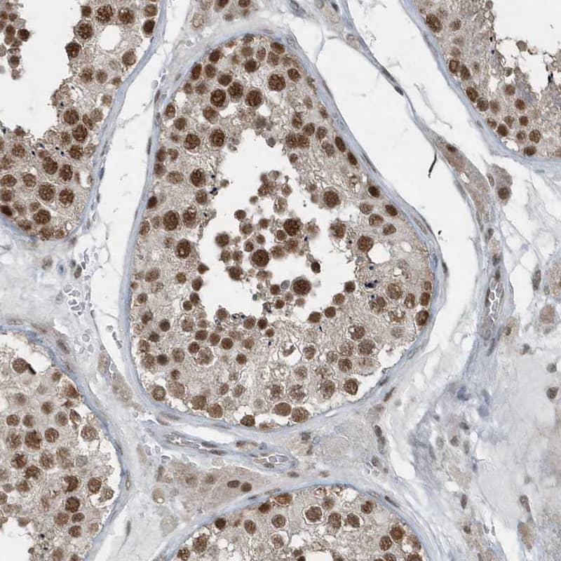 Immunohistochemistry-Paraffin YTHDC1 Antibody - BSA Free