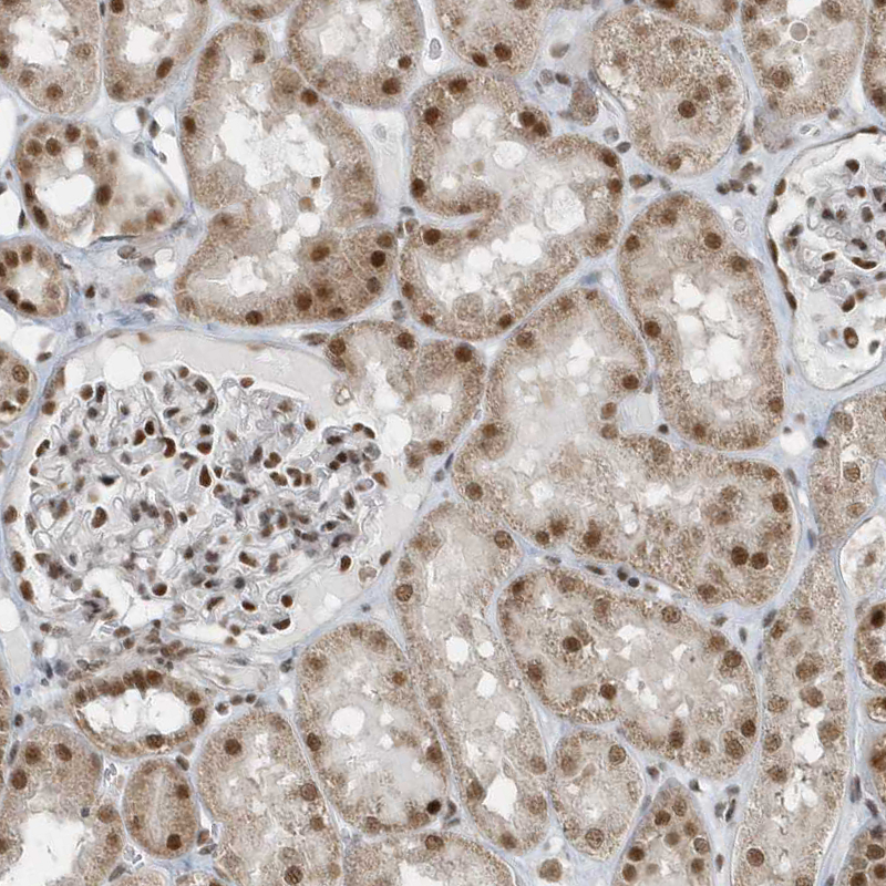 Immunohistochemistry-Paraffin YTHDC1 Antibody - BSA Free