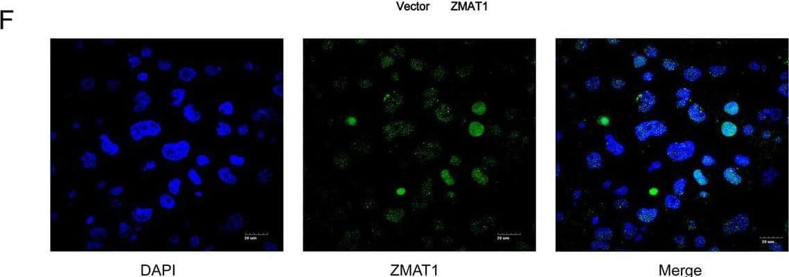 Immunocytochemistry/ Immunofluorescence ZMAT1 Antibody - BSA Free