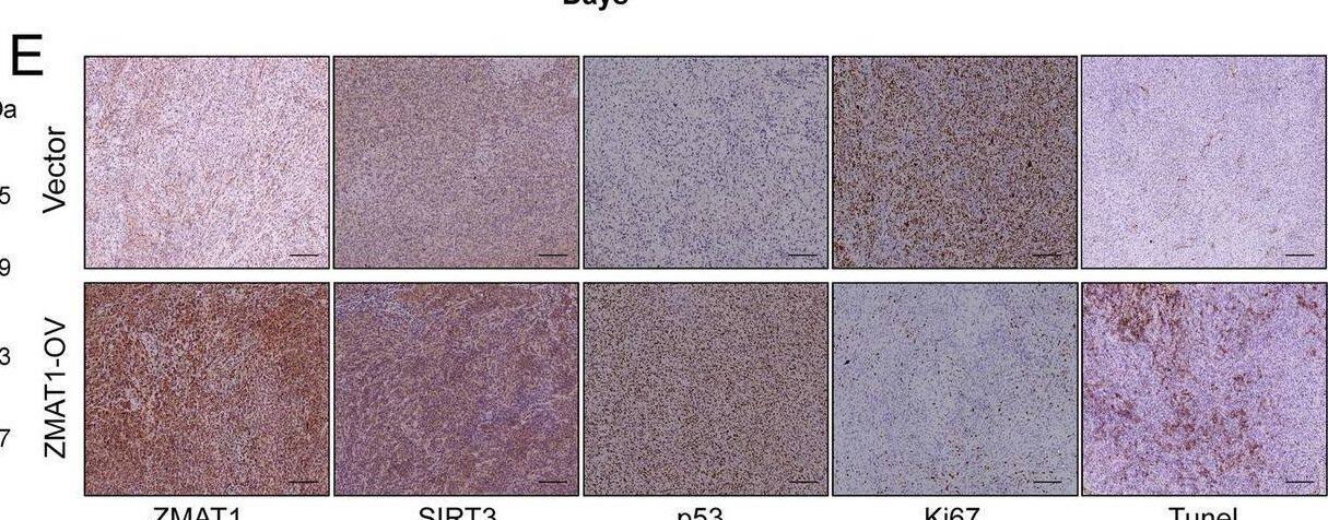 Immunohistochemistry ZMAT1 Antibody - BSA Free