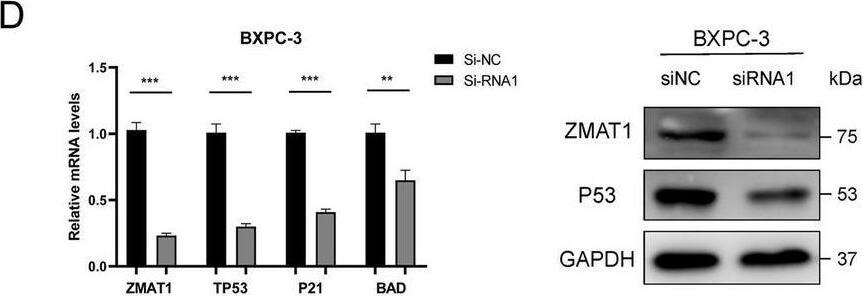 Western Blot ZMAT1 Antibody - BSA Free