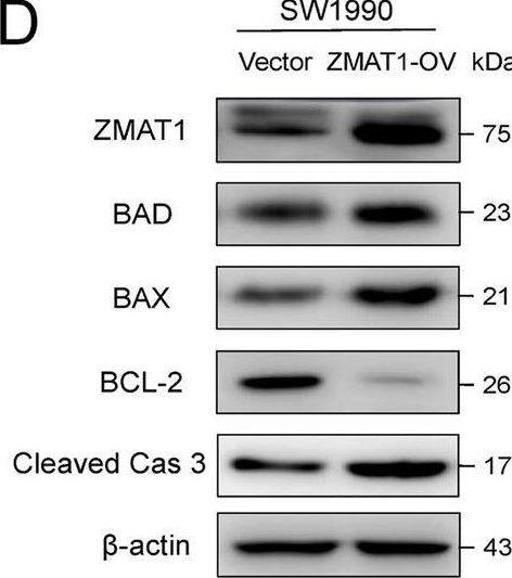 Western Blot ZMAT1 Antibody - BSA Free