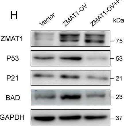 Western Blot ZMAT1 Antibody - BSA Free