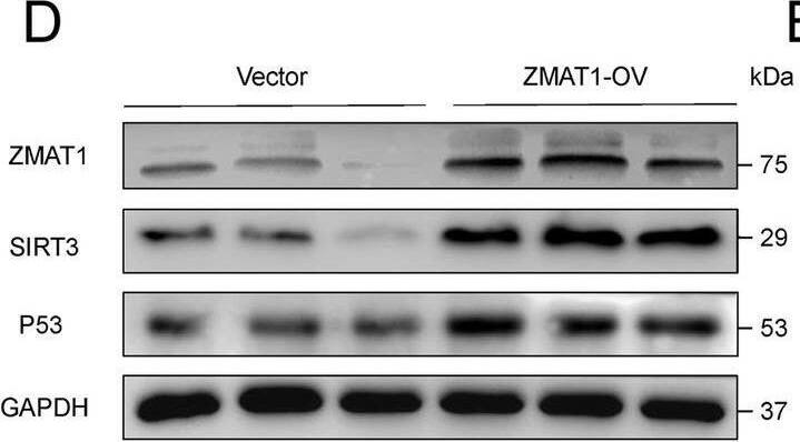 Western Blot ZMAT1 Antibody - BSA Free