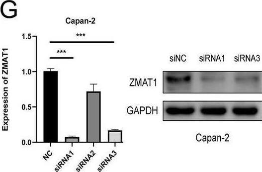 Western Blot ZMAT1 Antibody - BSA Free