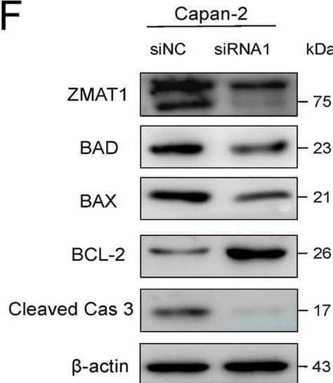 Western Blot ZMAT1 Antibody - BSA Free
