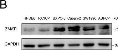 Western Blot ZMAT1 Antibody - BSA Free