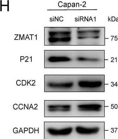 Western Blot ZMAT1 Antibody - BSA Free